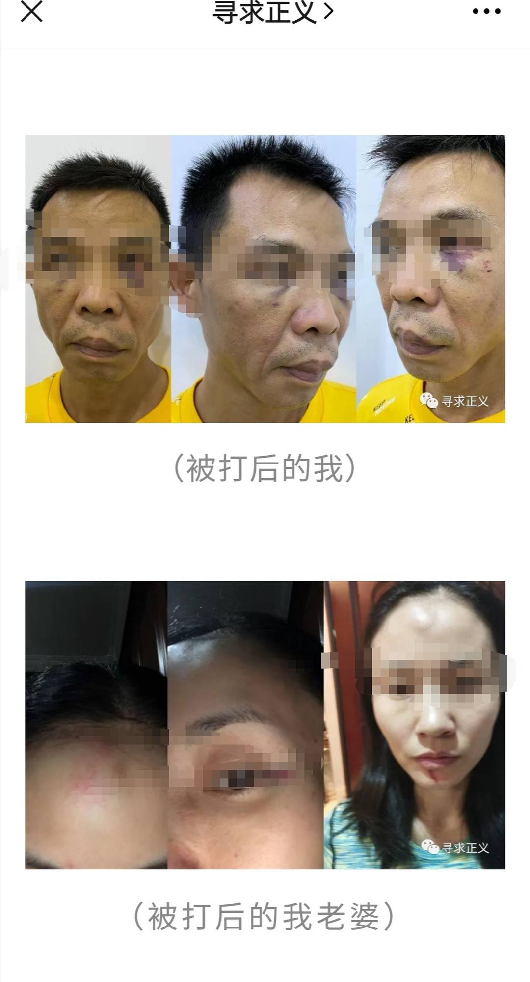 男子发文称被副局长锁在家中殴打！公安打人怎么处理？公安有哪些权利？