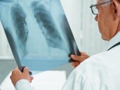 怎样排除自己不是结核?5个方法教你诊断肺结核