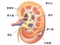 肾结石患者的饮食禁忌