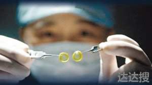 国产人工角膜或今年上半年用于临床 现在有人工角膜吗
